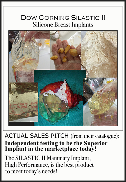 DOW CORNING SILASTIC II BLACK RS