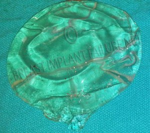 Resize of Blog Photo 13 watermark_edited-1