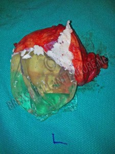 Resize of Blog Photo 3 watermark