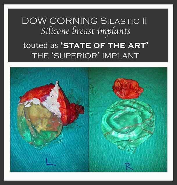 Silastic II Collage background RS