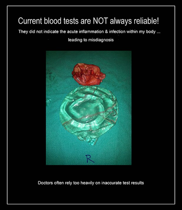 Flawed test results THIS flat rs