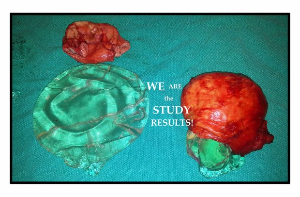 we are the study results photo stroke 10 crop 5