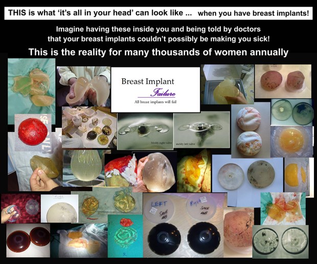 Imagine having these for Twitter 3 rs.jpg