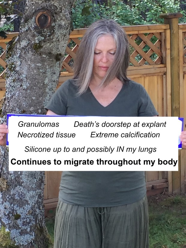 Silicone up to lungs 3