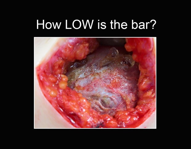 How Low is the Bar flat flat CROP