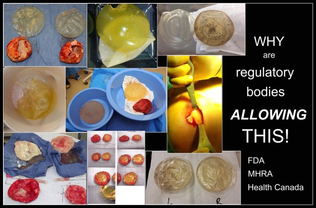 REGULATORY BODIES Epic FAIL