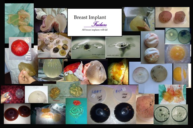 what in your head can look like rs