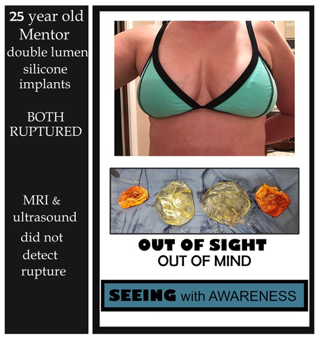 out-of-sight-out-of-mind-rs