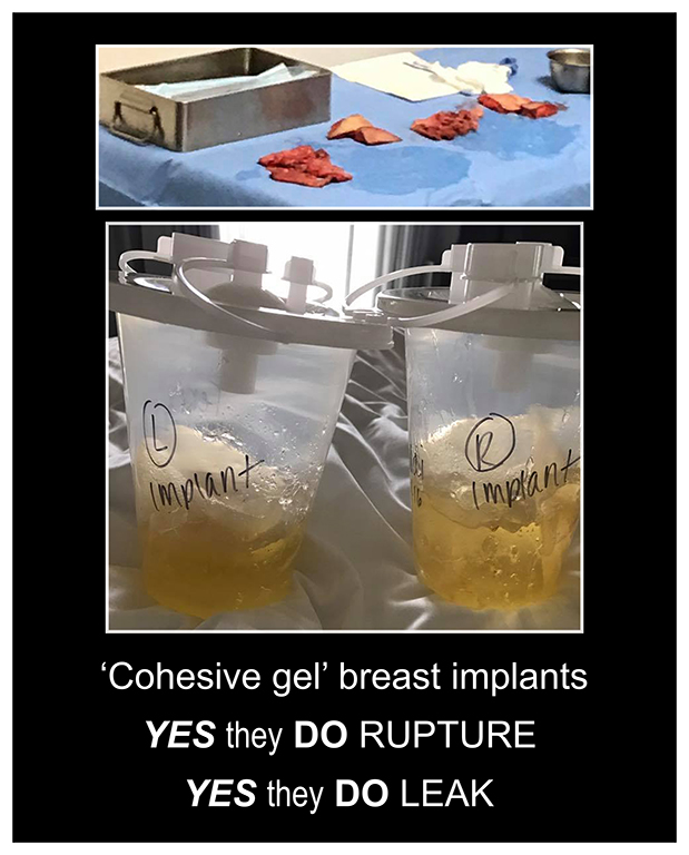 yes-they-do-rupture-2-background-rs