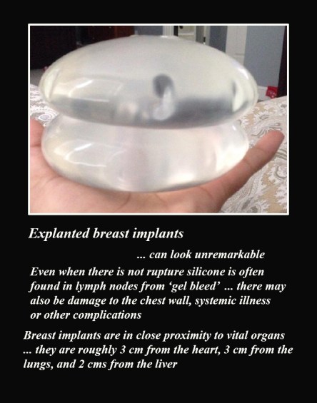 can look unremarkable