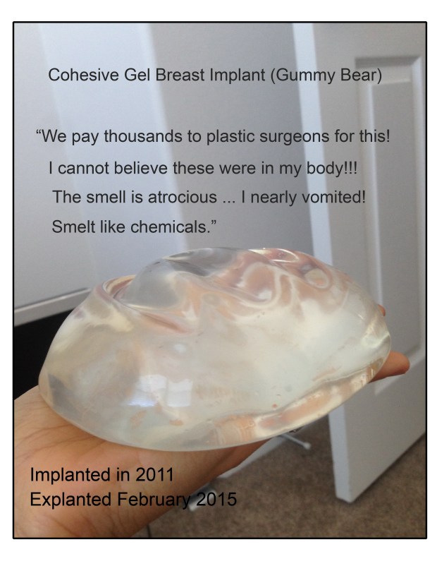 Scar Capsules Are NOT An Impermeable Barrier .. and other important ...