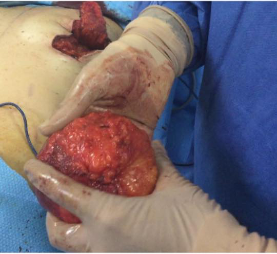 scar capsule for blog 9