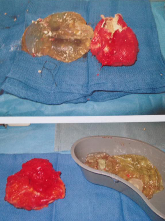 27 year old silicone