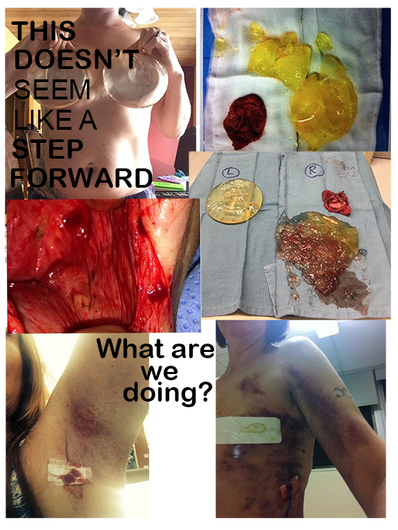 Doesn't seem like a step forward 3