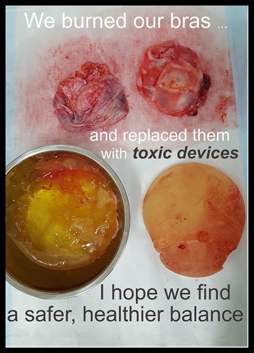 we burned our bras revisited