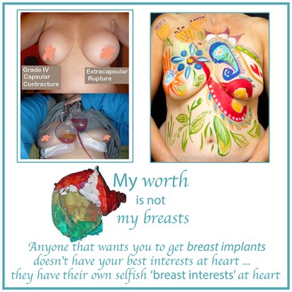 explant worth for blog