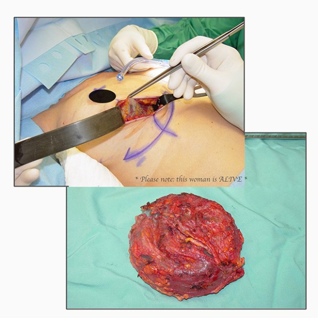 September 25 Memorial collage rs