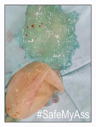 Define safe enough safe my ass 2 rs