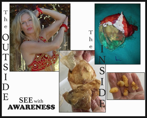 SEE WITH AWARENESS RS