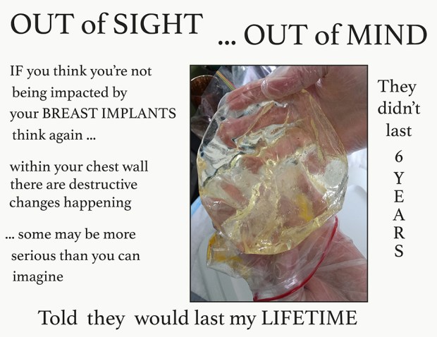 Told they would last a lifetime RS