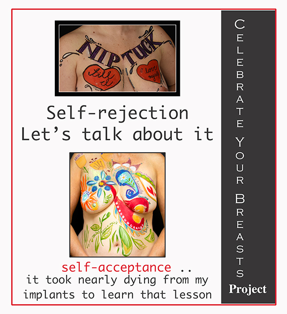 self-acceptance cyb 3 RS