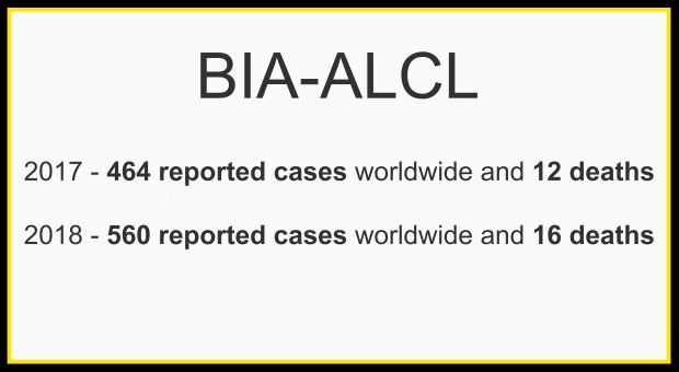 bia-alcl cases worldwide