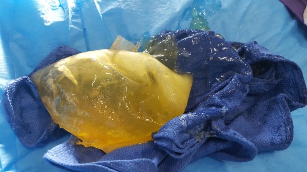 Rhonda Hatz uwp 9 yr old gummy.jpg